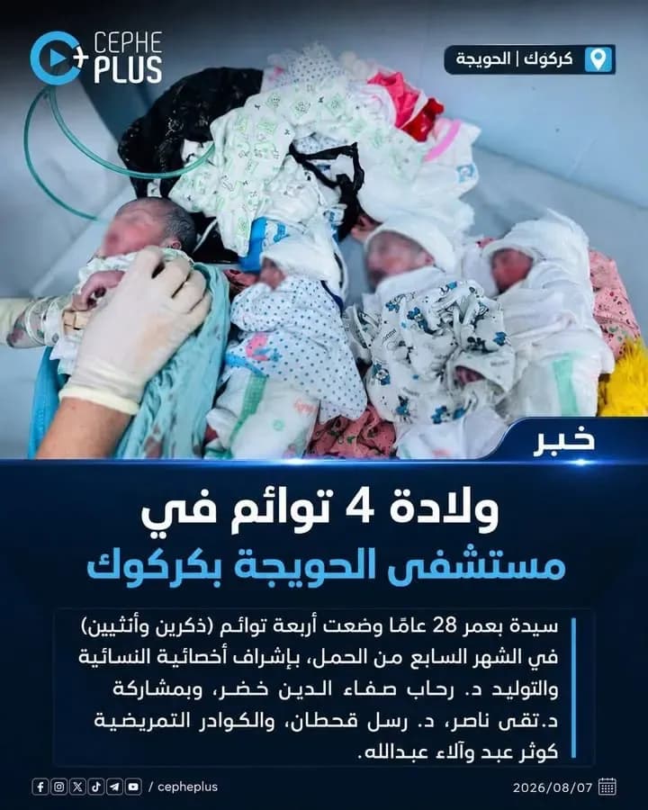 ولادة نادرة في الحويجة..